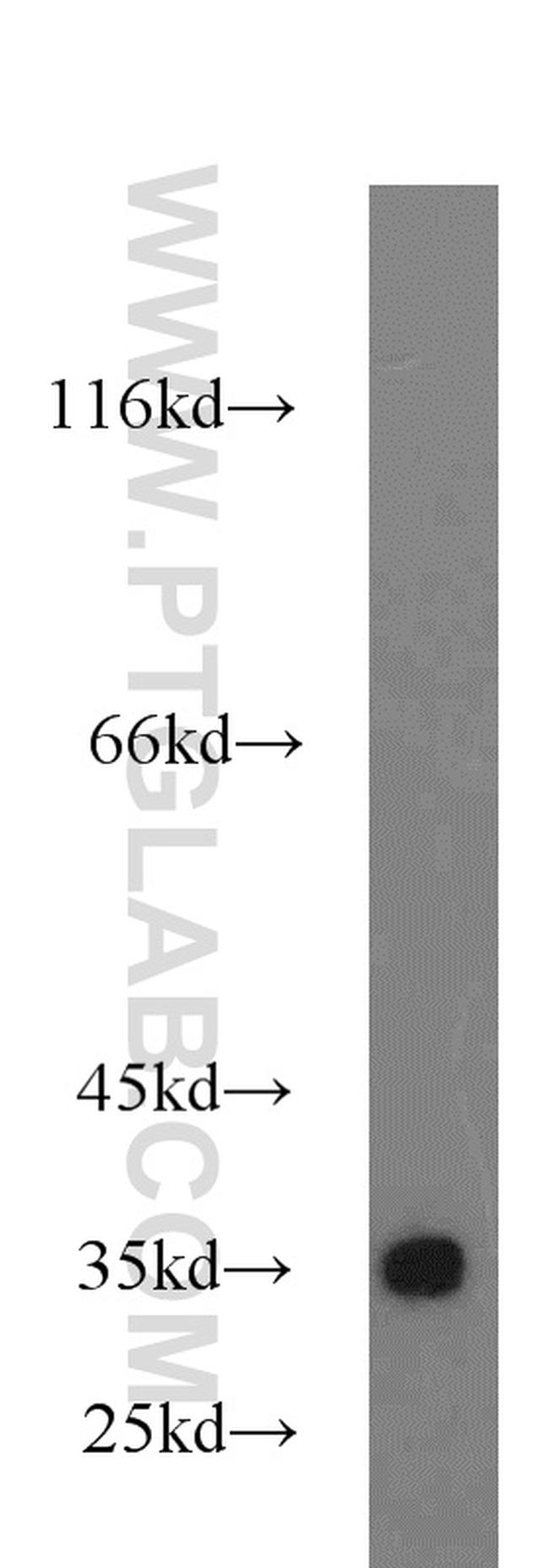 PINK1 Antibody in Western Blot (WB)