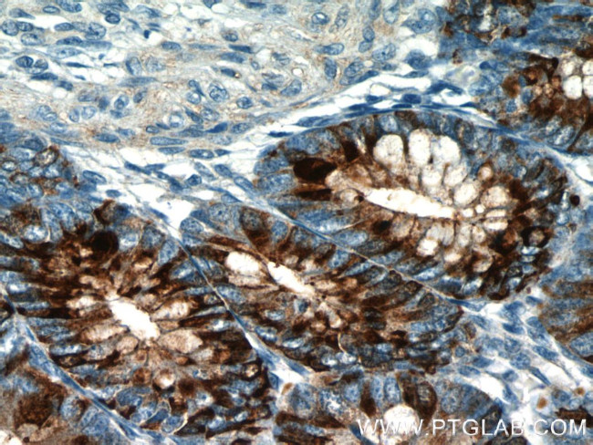 Trefoil factor 3 Antibody in Immunohistochemistry (Paraffin) (IHC (P))