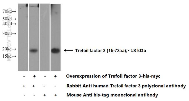 Trefoil factor 3 Antibody in Western Blot (WB)