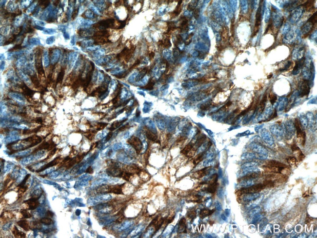 Trefoil factor 3 Antibody in Immunohistochemistry (Paraffin) (IHC (P))