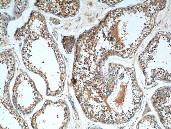 TICAM1 Antibody in Immunohistochemistry (Paraffin) (IHC (P))