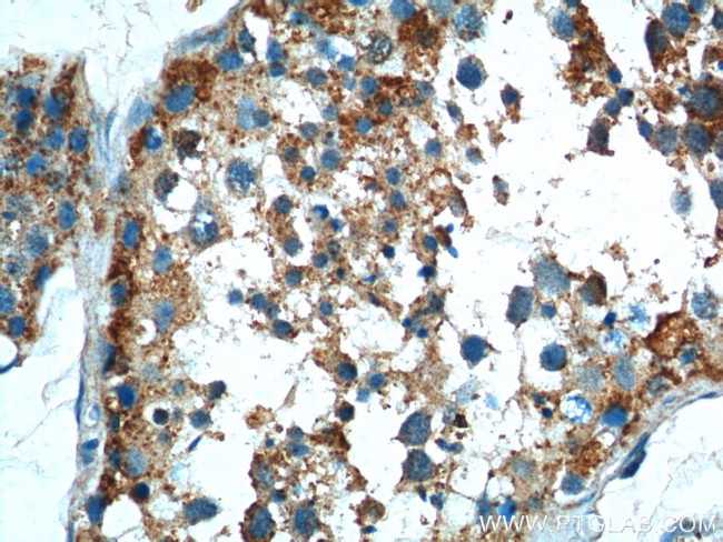 TICAM1 Antibody in Immunohistochemistry (Paraffin) (IHC (P))