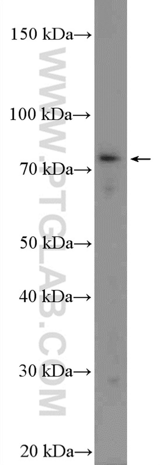 TICAM1 Antibody in Western Blot (WB)