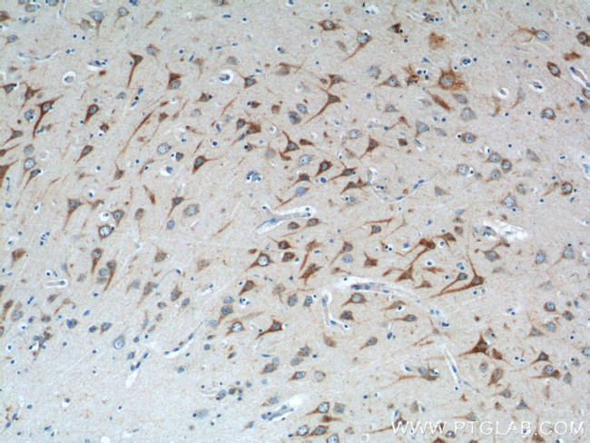 TICAM1 Antibody in Immunohistochemistry (Paraffin) (IHC (P))