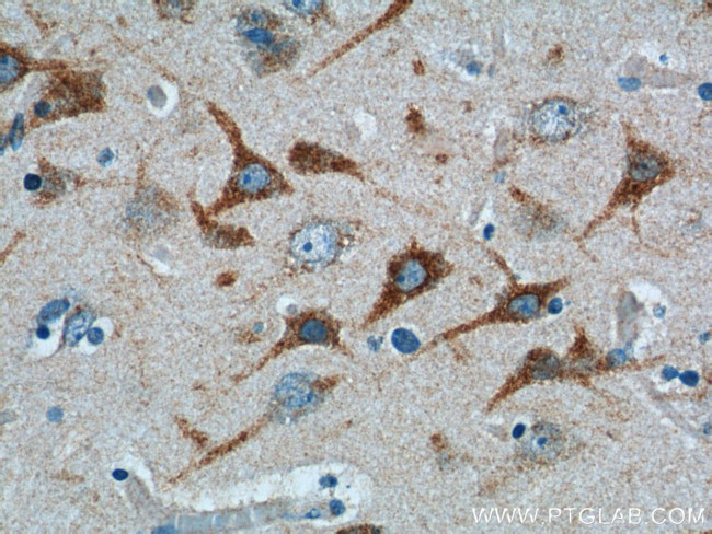 TICAM1 Antibody in Immunohistochemistry (Paraffin) (IHC (P))