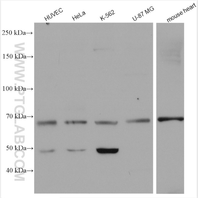 Angiopoietin 1 Antibody in Western Blot (WB)