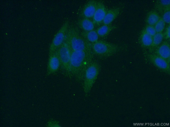 Angiopoietin 1 Antibody in Immunocytochemistry (ICC/IF)