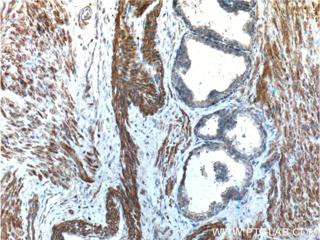 Angiopoietin 1 Antibody in Immunohistochemistry (Paraffin) (IHC (P))