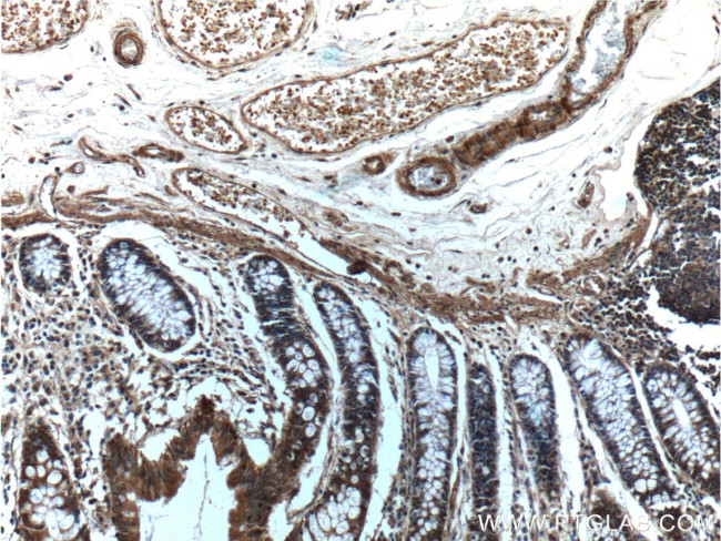 Angiopoietin 1 Antibody in Immunohistochemistry (Paraffin) (IHC (P))