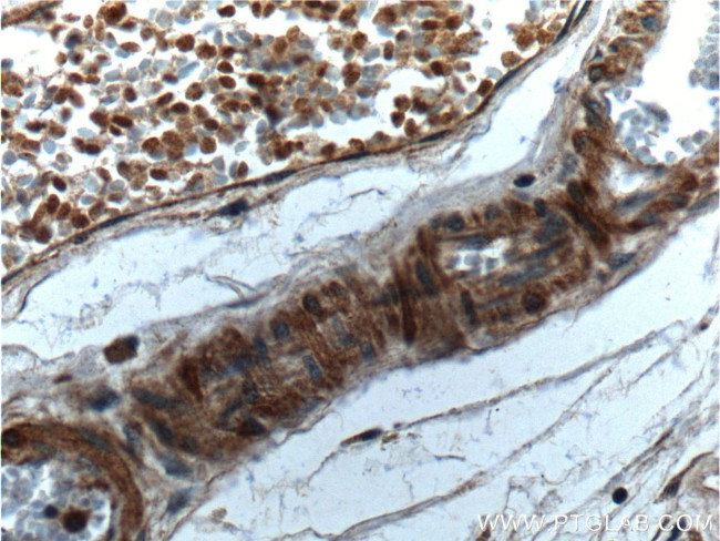 Angiopoietin 1 Antibody in Immunohistochemistry (Paraffin) (IHC (P))