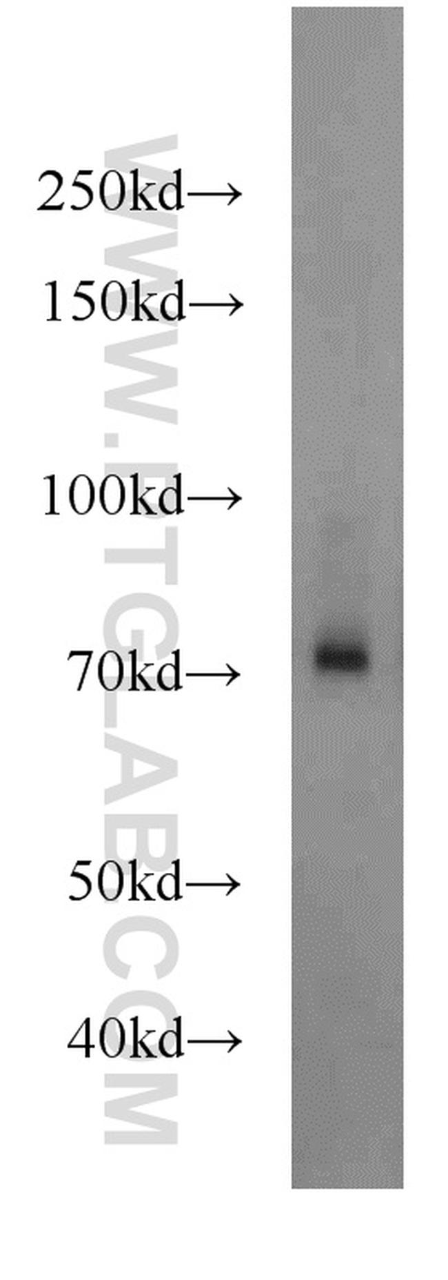 Angiopoietin 1 Antibody in Western Blot (WB)