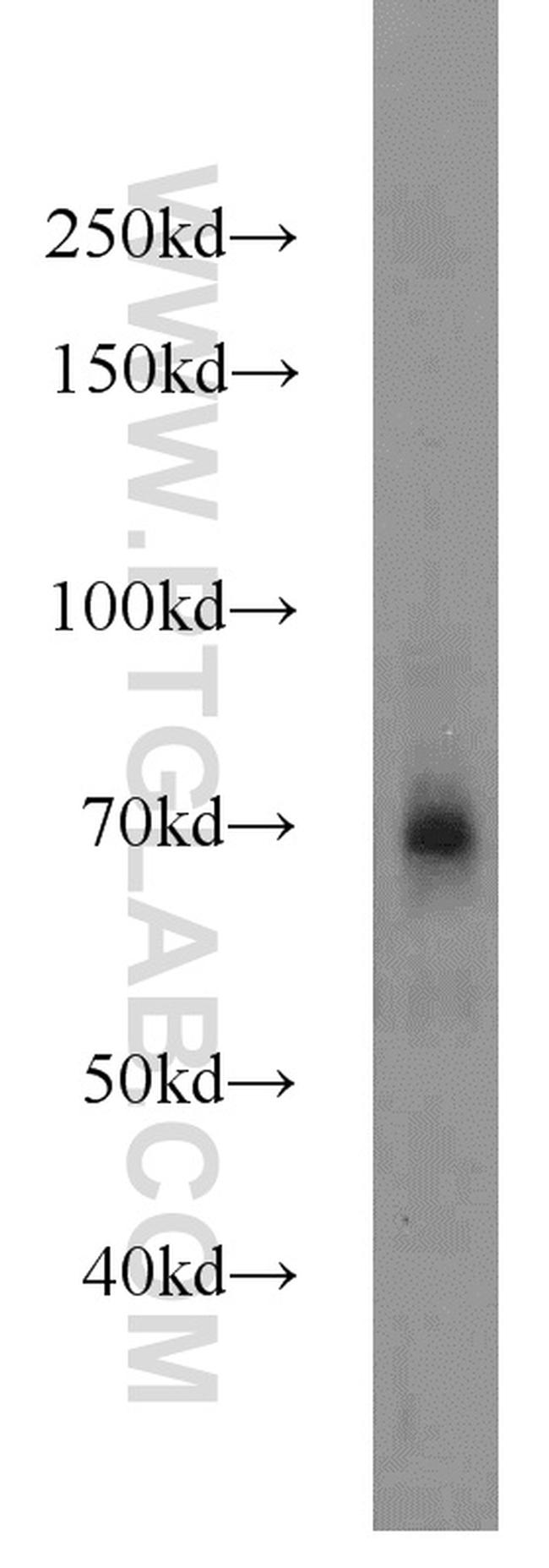 Angiopoietin 1 Antibody in Western Blot (WB)