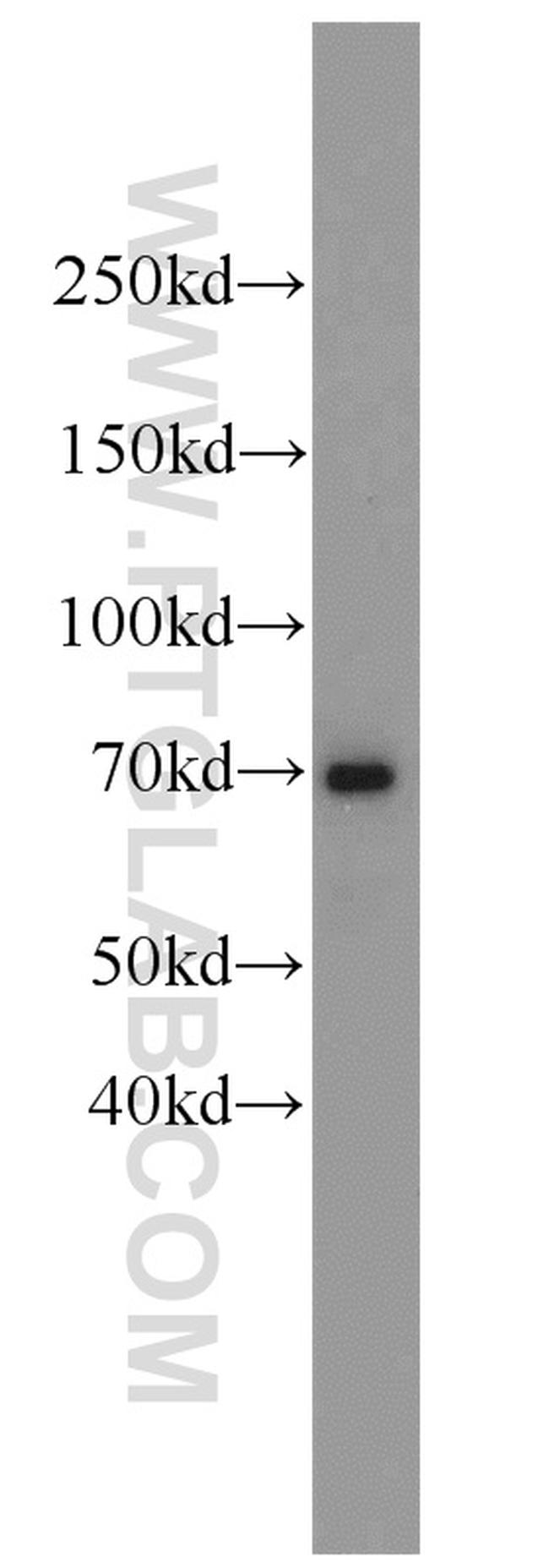 Angiopoietin 1 Antibody in Western Blot (WB)