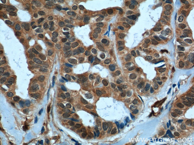 TAZ Antibody in Immunohistochemistry (Paraffin) (IHC (P))