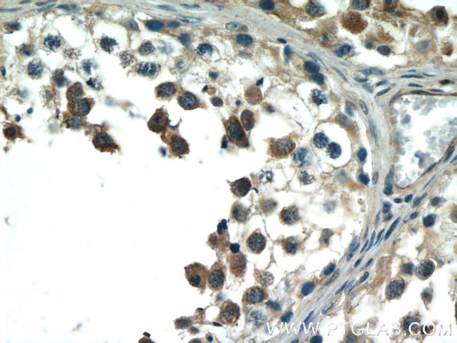 BCMO1 Antibody in Immunohistochemistry (Paraffin) (IHC (P))