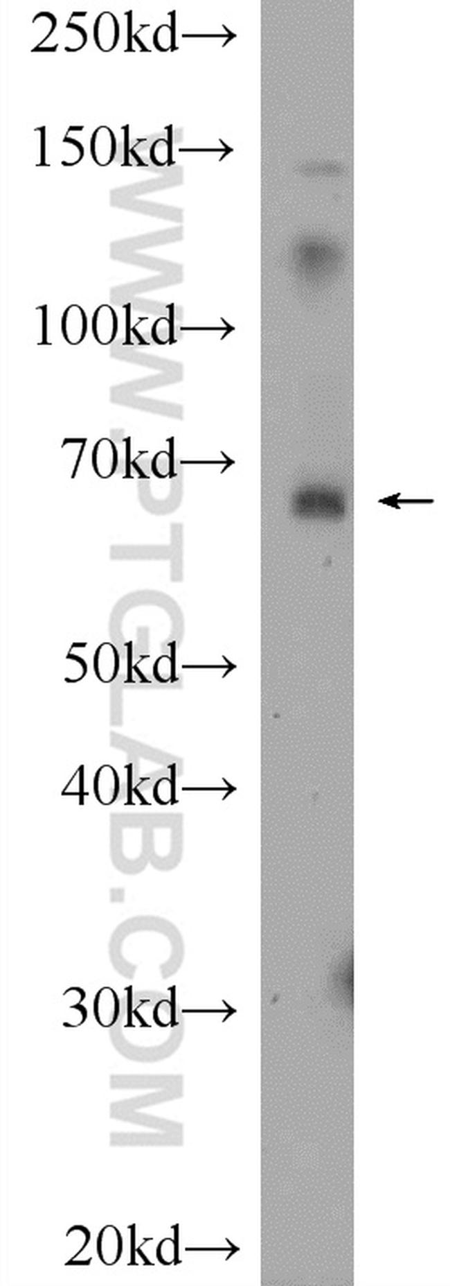 BCMO1 Antibody in Western Blot (WB)