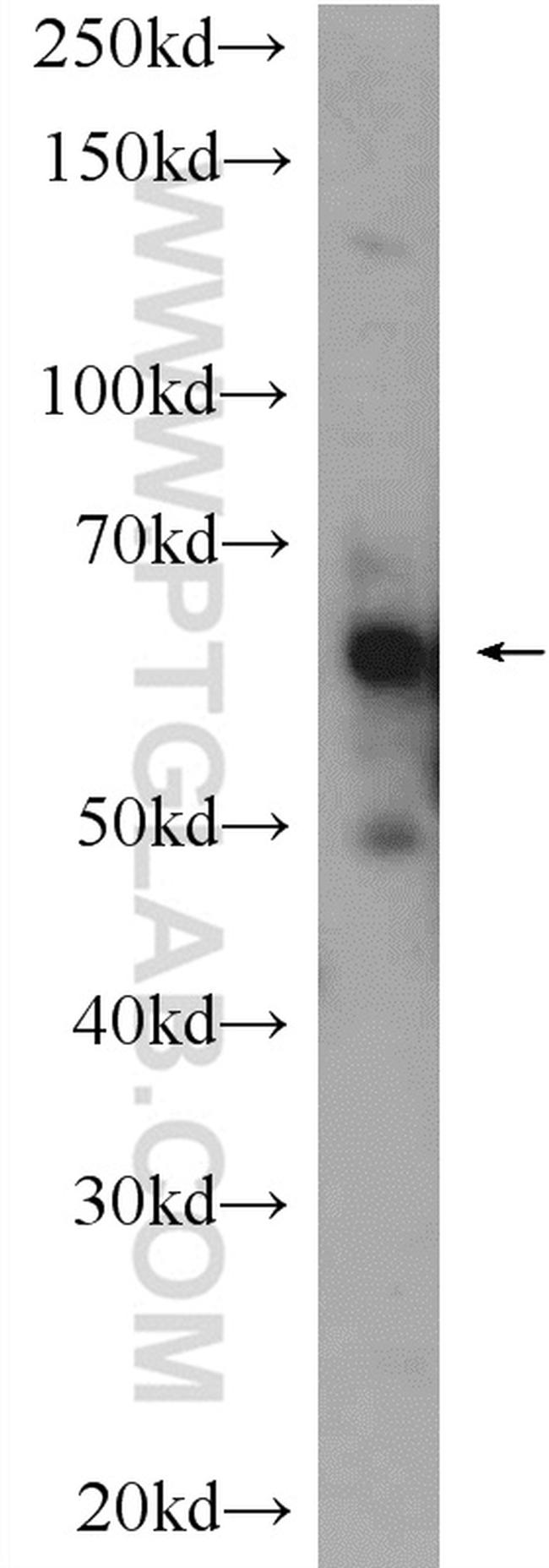 BCMO1 Antibody in Western Blot (WB)