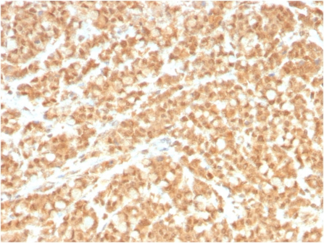 ICOS-L/ICOS Ligand/B7RP-1 (Immuno-Oncology Target) Antibody in Immunohistochemistry (Paraffin) (IHC (P))