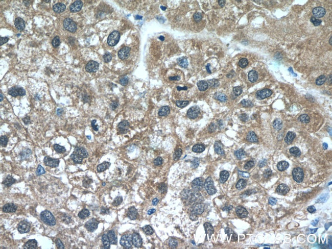 IDH1 Antibody in Immunohistochemistry (Paraffin) (IHC (P))