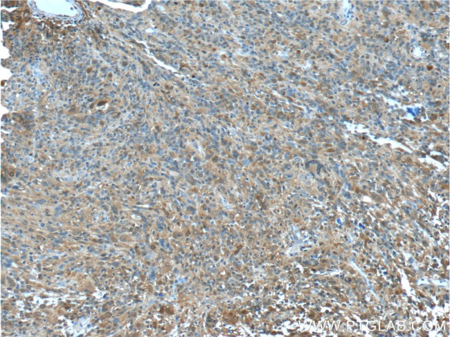 IDH1 Antibody in Immunohistochemistry (Paraffin) (IHC (P))