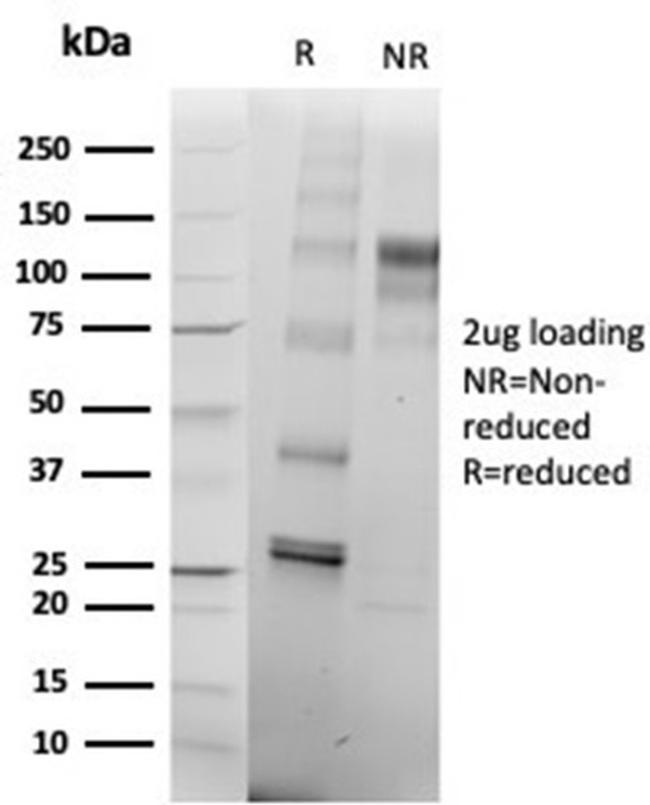 SATB2 (Colorectal Carcinoma Marker) Antibody in Immunoelectrophoresis (IE)