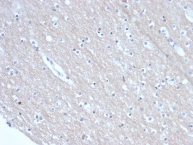 SATB2 (Colorectal Carcinoma Marker) Antibody in Immunohistochemistry (Paraffin) (IHC (P))