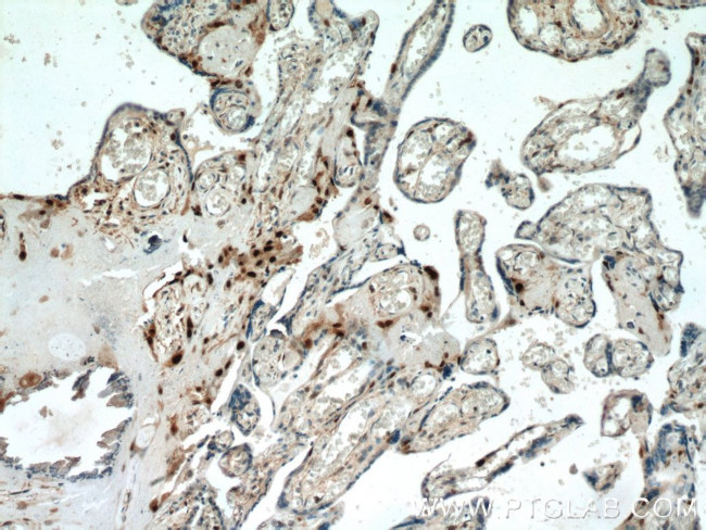 p57Kip2 Antibody in Immunohistochemistry (Paraffin) (IHC (P))