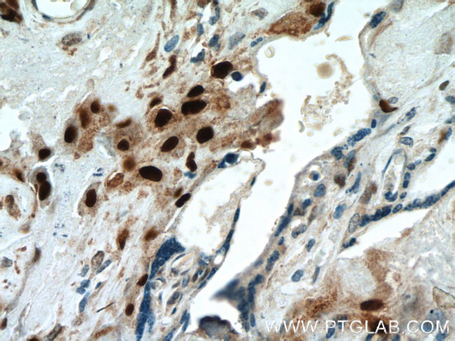 p57Kip2 Antibody in Immunohistochemistry (Paraffin) (IHC (P))