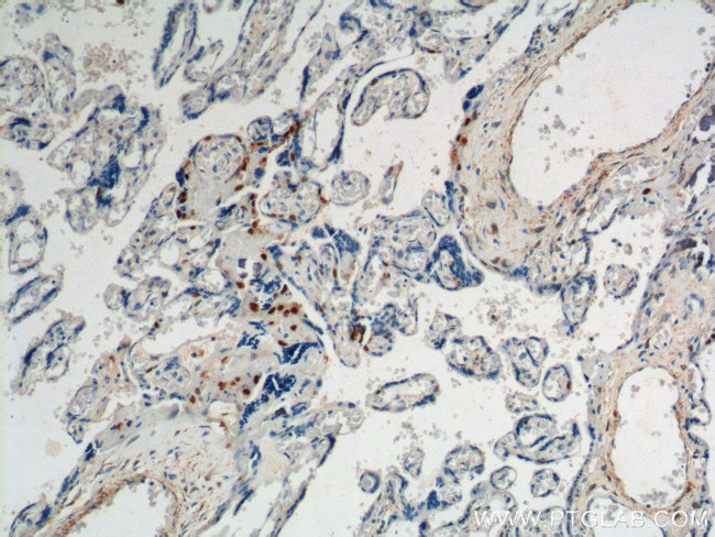 p57Kip2 Antibody in Immunohistochemistry (Paraffin) (IHC (P))