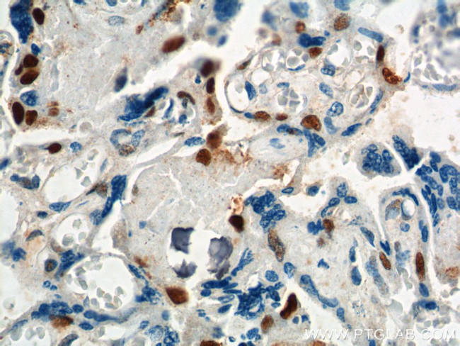 p57Kip2 Antibody in Immunohistochemistry (Paraffin) (IHC (P))