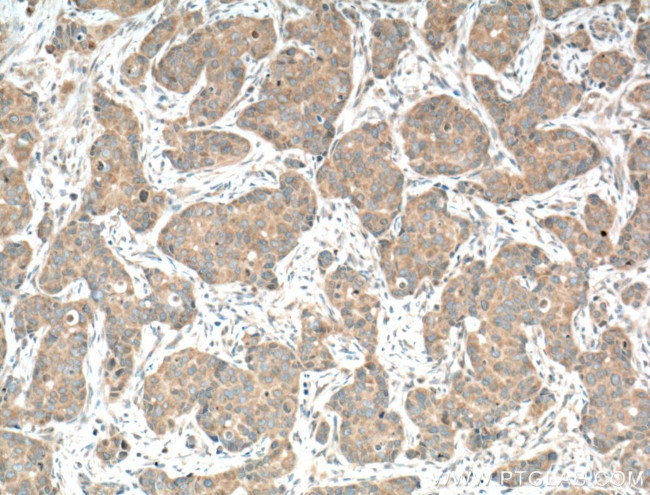 CAMLG Antibody in Immunohistochemistry (Paraffin) (IHC (P))