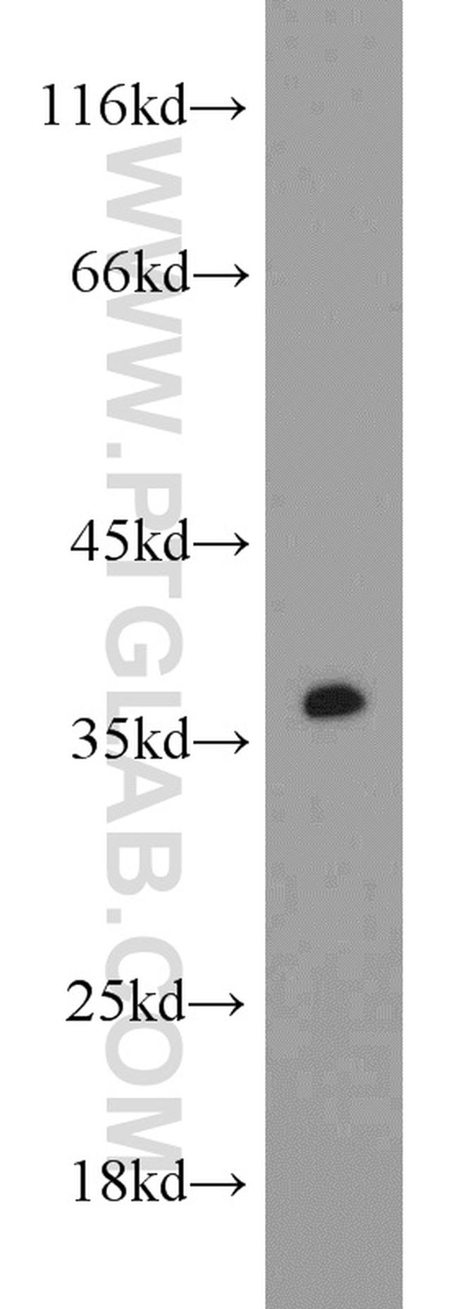 CAMLG Antibody in Western Blot (WB)