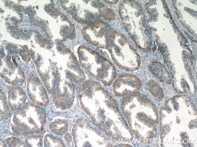 Eg5 Antibody in Immunohistochemistry (Paraffin) (IHC (P))