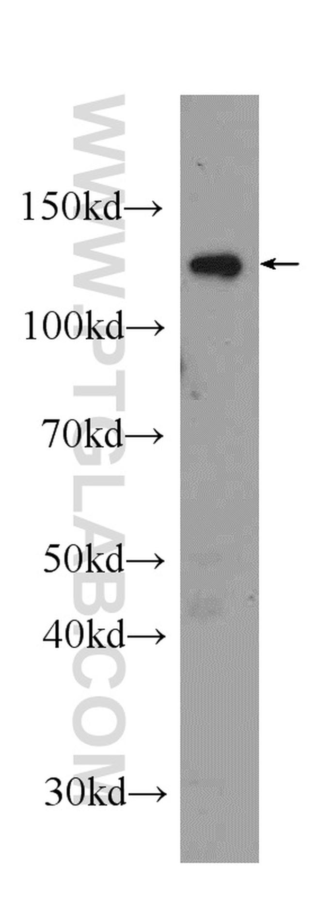 Eg5 Antibody in Western Blot (WB)