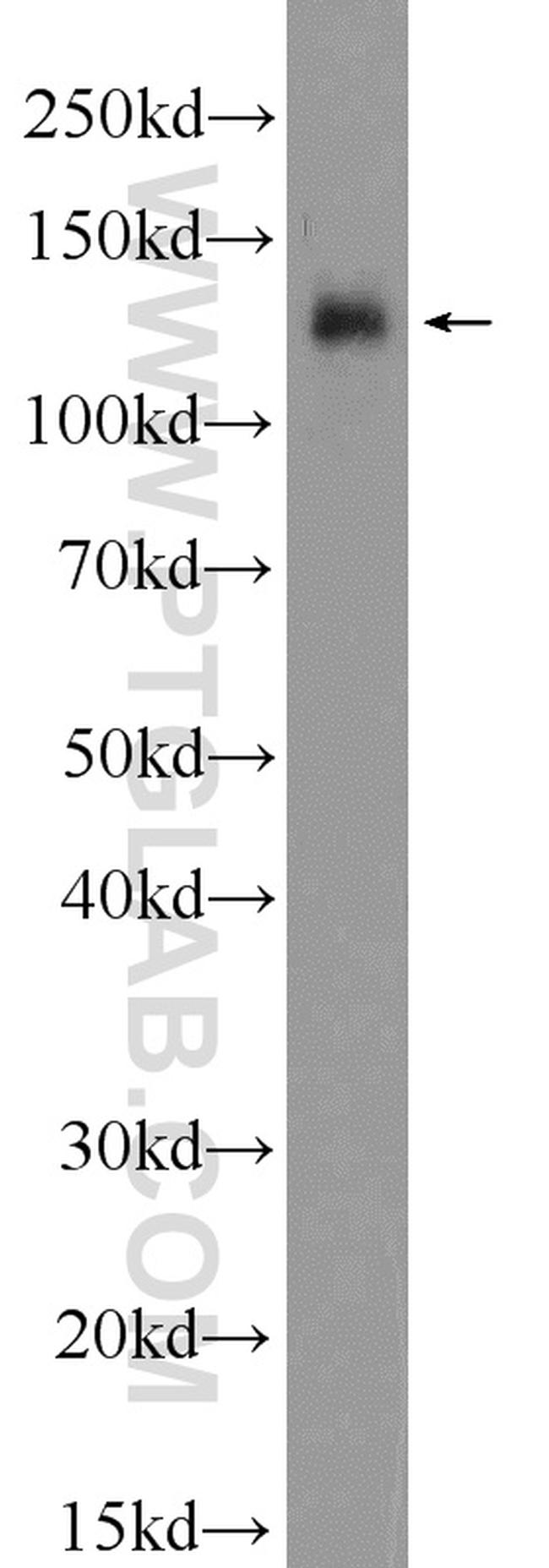 Eg5 Antibody in Western Blot (WB)