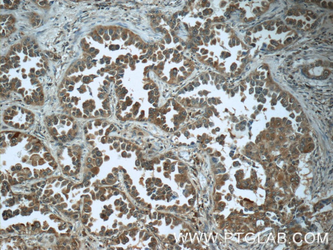 Eg5 Antibody in Immunohistochemistry (Paraffin) (IHC (P))