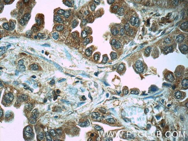 Eg5 Antibody in Immunohistochemistry (Paraffin) (IHC (P))