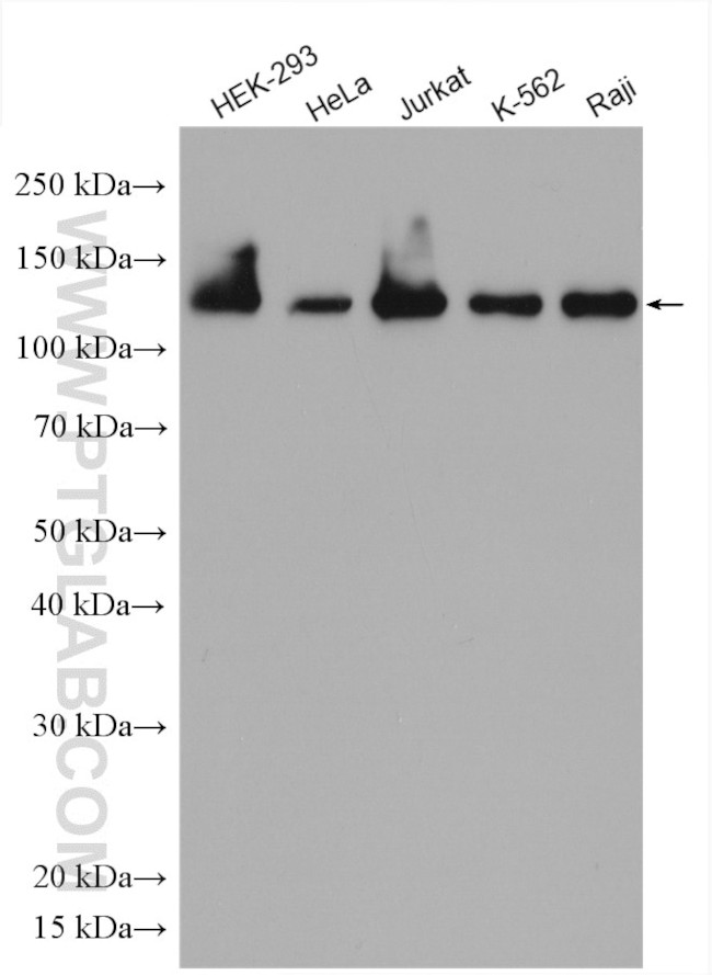 Eg5 Antibody in Western Blot (WB)