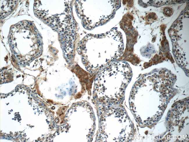 C16orf84 Antibody in Immunohistochemistry (Paraffin) (IHC (P))