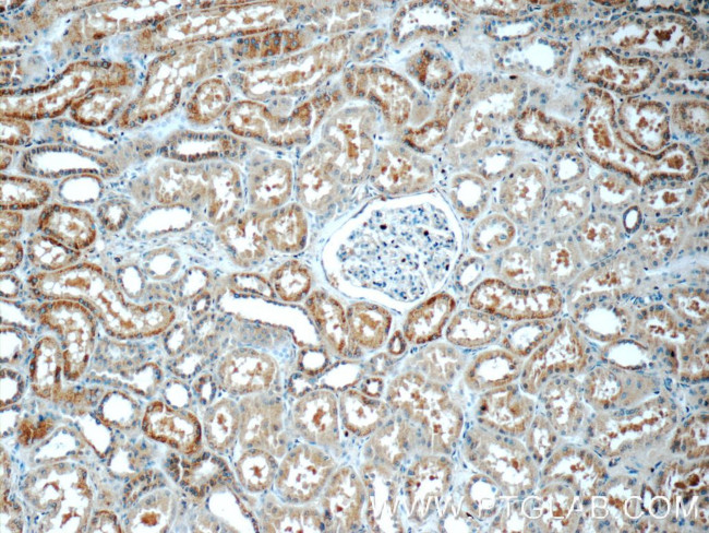 C16orf84 Antibody in Immunohistochemistry (Paraffin) (IHC (P))