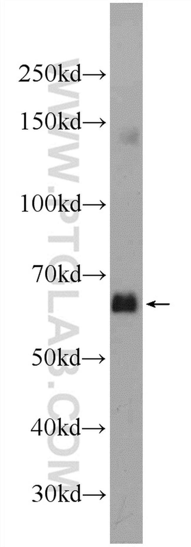 C16orf84 Antibody in Western Blot (WB)