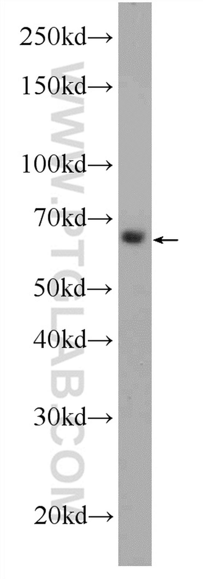 C16orf84 Antibody in Western Blot (WB)