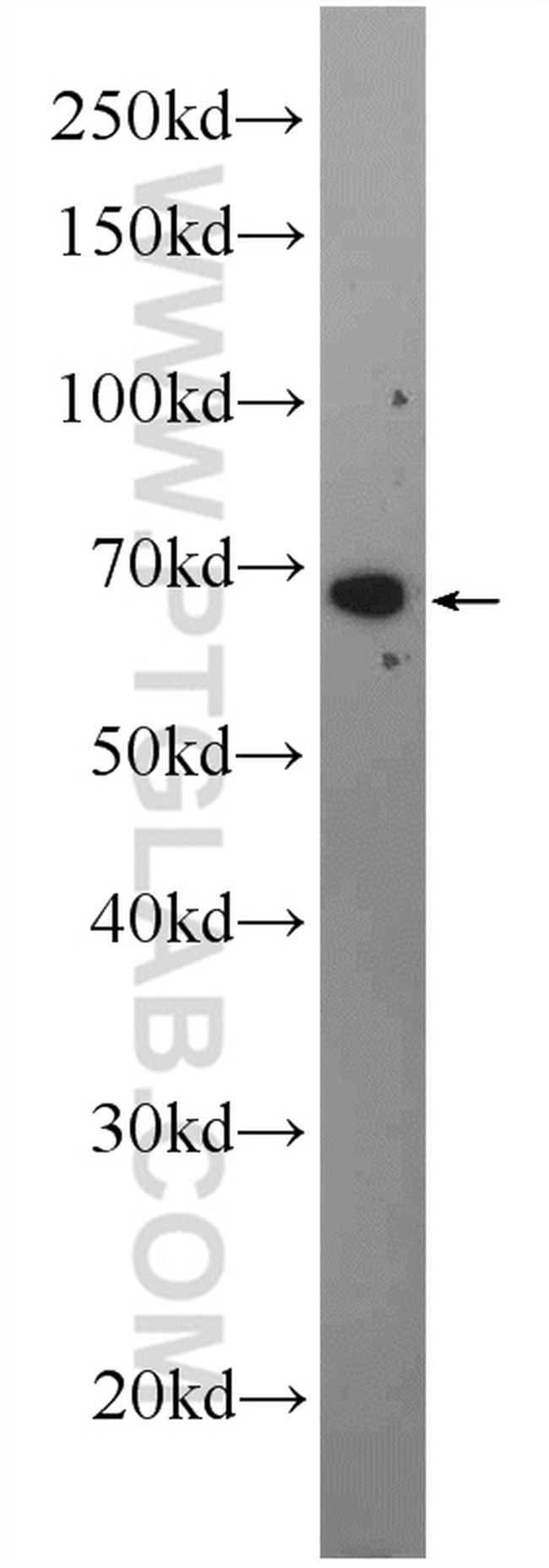 C16orf84 Antibody in Western Blot (WB)