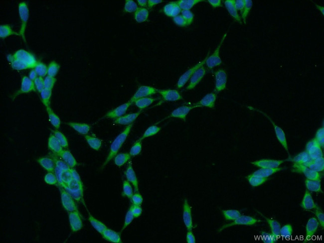 C16orf84 Antibody in Immunocytochemistry (ICC/IF)