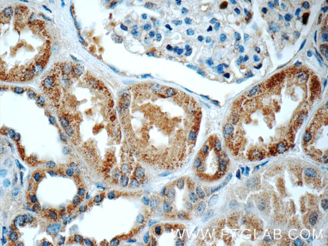 C16orf84 Antibody in Immunohistochemistry (Paraffin) (IHC (P))