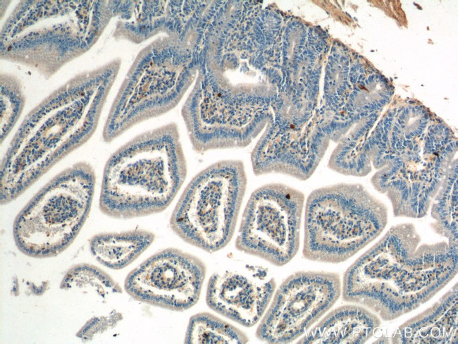 Chromogranin A Antibody in Immunohistochemistry (Paraffin) (IHC (P))