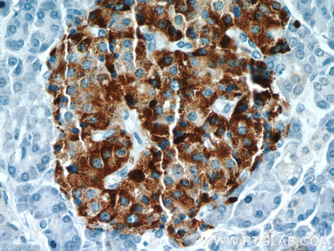 Chromogranin A Antibody in Immunohistochemistry (Paraffin) (IHC (P))