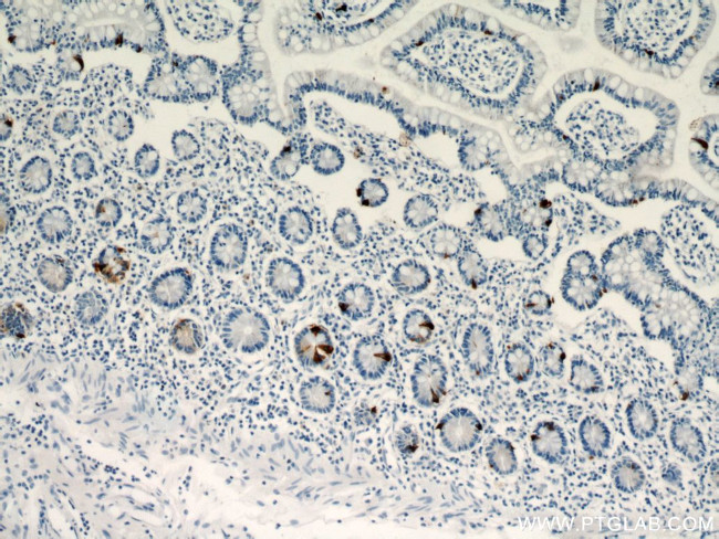 Chromogranin A Antibody in Immunohistochemistry (Paraffin) (IHC (P))