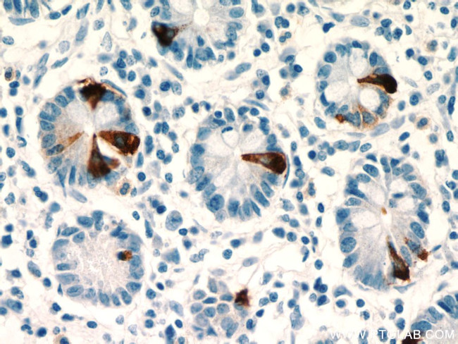 Chromogranin A Antibody in Immunohistochemistry (Paraffin) (IHC (P))