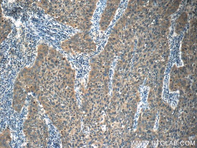 KDELC2 Antibody in Immunohistochemistry (Paraffin) (IHC (P))